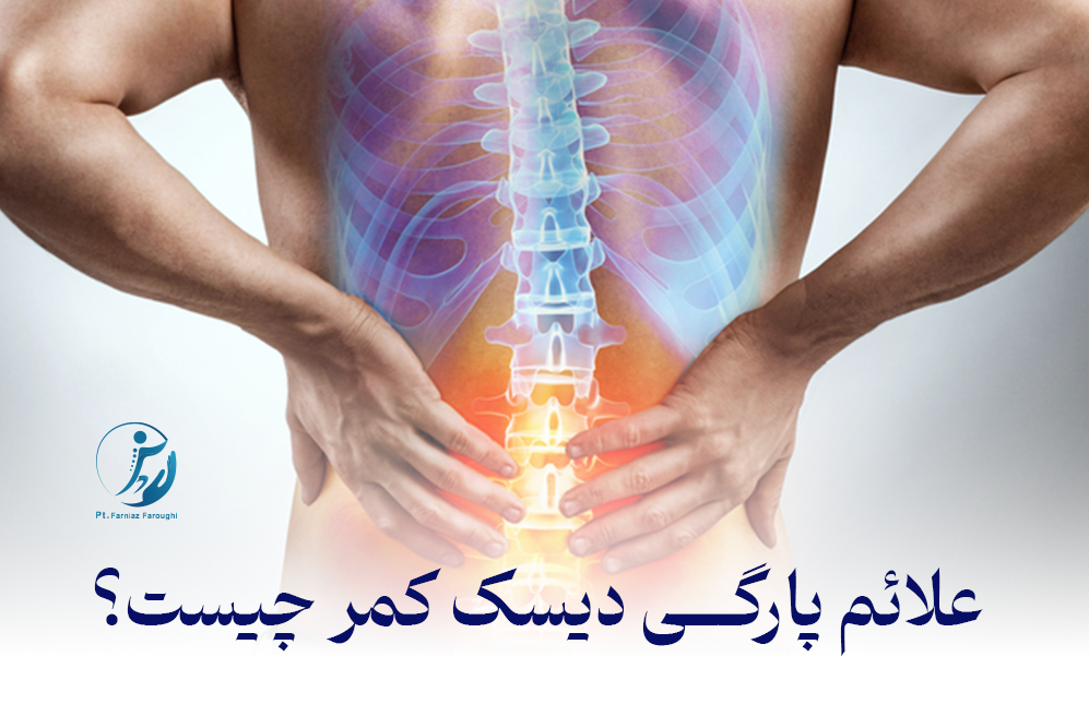 علائم پارگی دیسک کمر