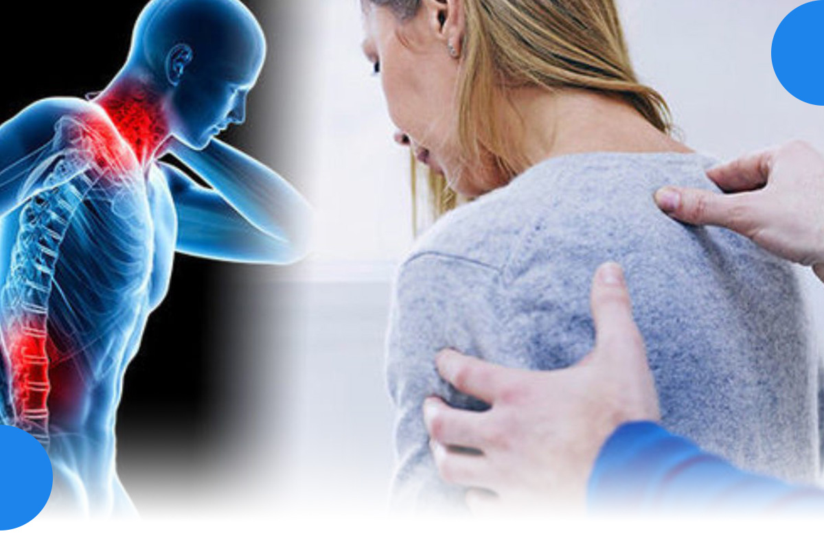 سندرم فیبرومیالژیا چیست؟